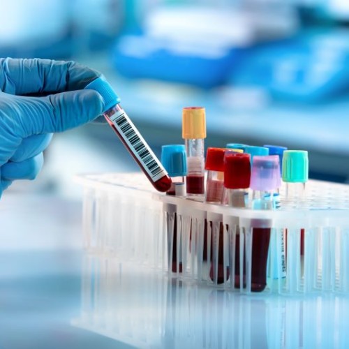 La drépanocytose, parlons-en 💉