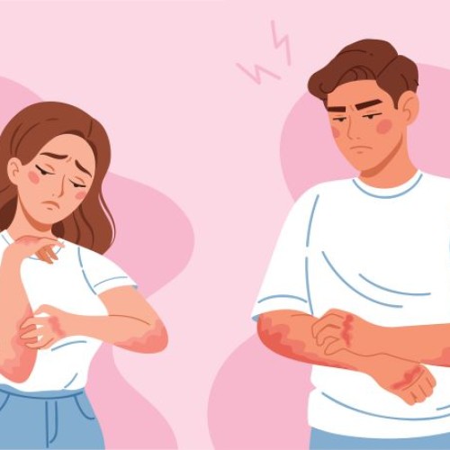 Une journée pour sensibiliser à l'eczéma atopique au CHU de Nantes
