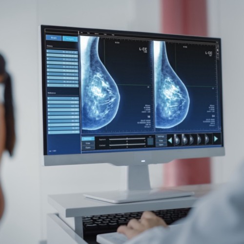 Cancer du sein : s'informer à l'hôpital 🥼