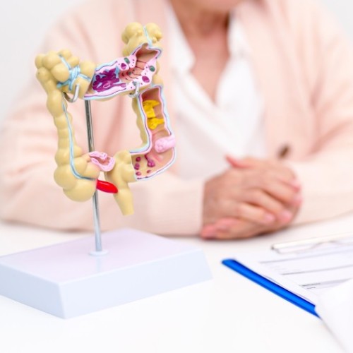 CHU de Montpellier : Des actions pour lever les tabous sur le cancer colorectal