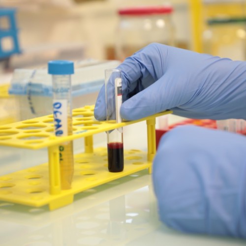 À Toulouse, la prise en charge du cancer du sein évolue