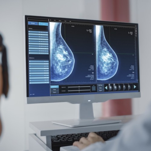 Mobilisation mondiale contre le cancer du sein triple négatif