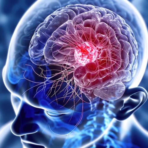 Mai en gris : Sensibiliser au cancer du cerveau