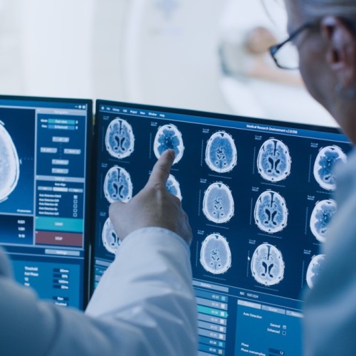 Une journée pour sensibiliser aux cancers du cerveau